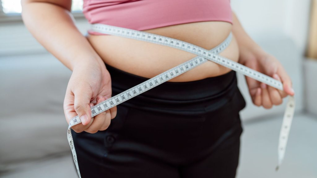 Treatment Options for Severe Obesity