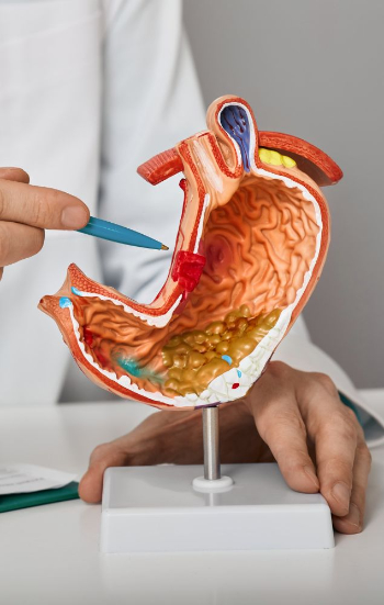 Gastric Band Stomach Model