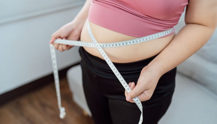 Top 5 Steps to Prepare for Weight Loss Surgery