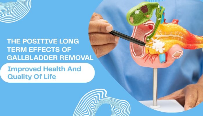 The Positive Long-Term Effects of Gallbladder Removal: Improved Health and Quality of Life