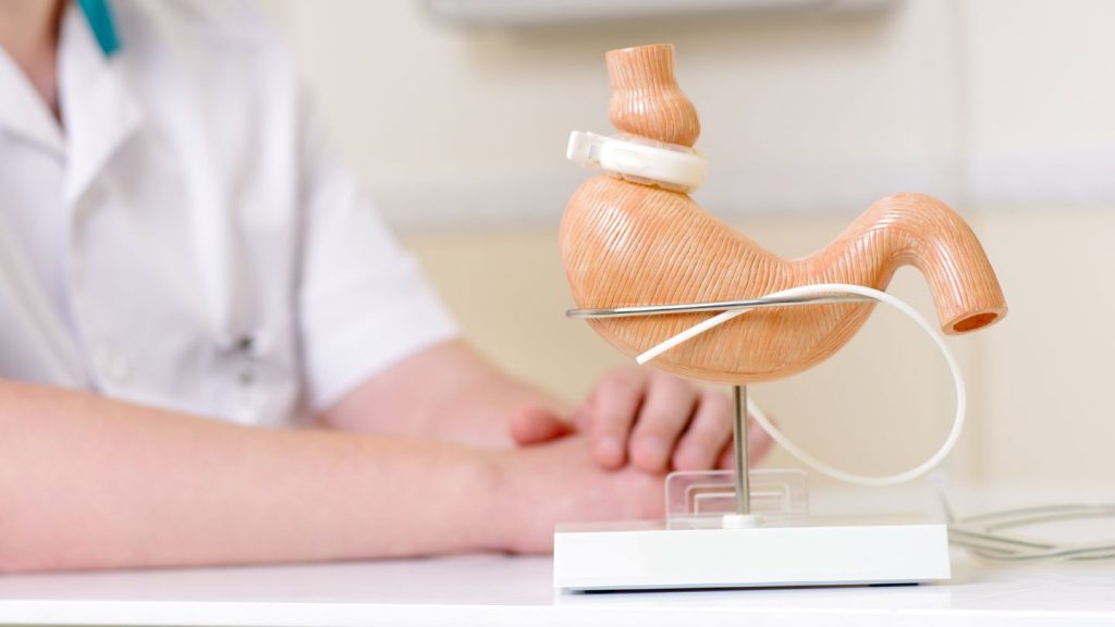 Understanding the Lap Band Procedure