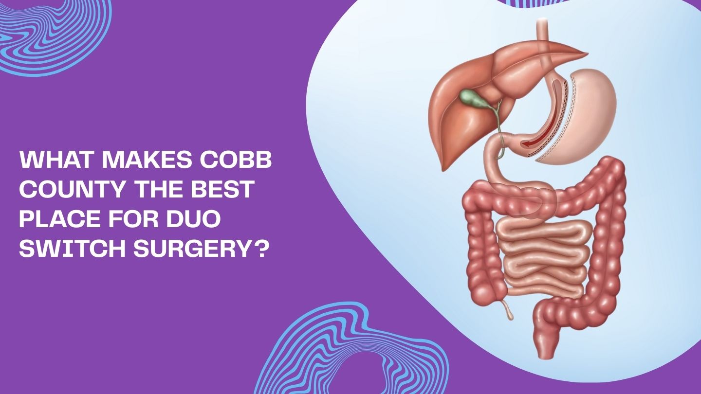 What Makes Cobb County the Best Place for Duo Switch Surgery? What Makes Cobb County the Best Place for Duo Switch Surgery?