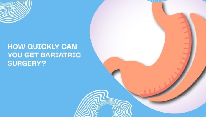 How Quickly Can You Get Bariatric Surgery? How Quickly Can You Get Bariatric Surgery?