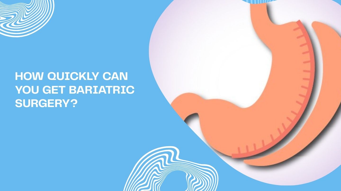 How Quickly Can You Get Bariatric Surgery? How Quickly Can You Get Bariatric Surgery?