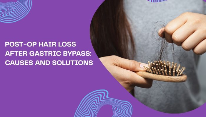 Post-Op Hair Loss After Gastric Bypass: Causes and Solutions Post-Op Hair Loss After Gastric Bypass: Causes and Solutions