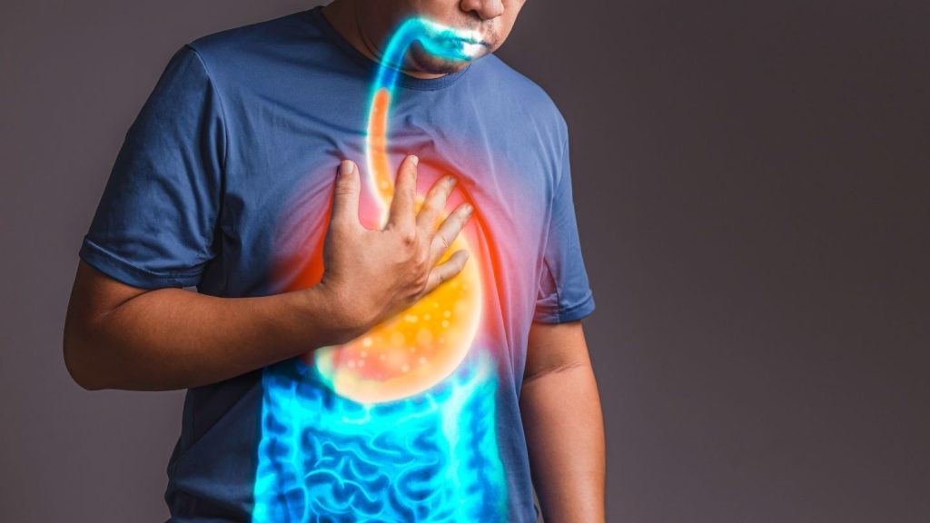 Surgical Options for Severe GERD