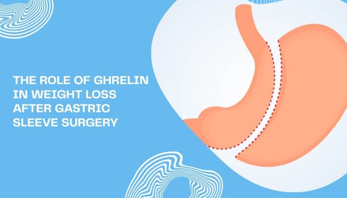The Role of Ghrelin in Weight Loss After Gastric Sleeve Surgery The Role of Ghrelin in Weight Loss After Gastric Sleeve Surgery