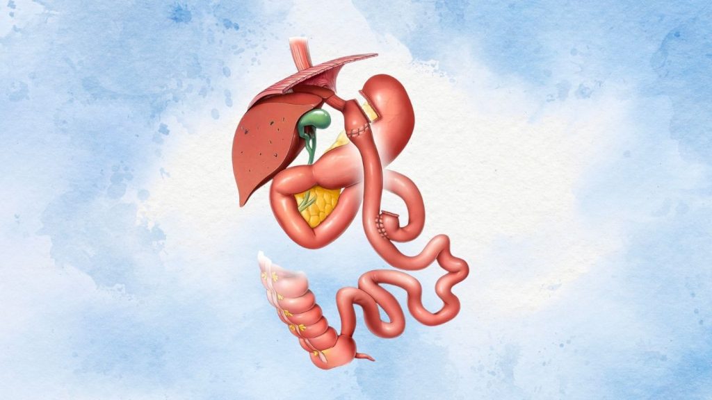 The Surgical Procedure: Step-by-Step