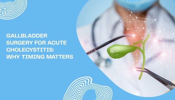 Gallbladder Surgery for Acute Cholecystitis: Why Timing Matters Gallbladder Surgery for Acute Cholecystitis: Why Timing Matters