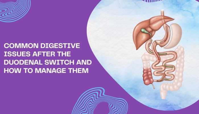 Common Digestive Issues After the Duodenal Switch and How to Manage Them