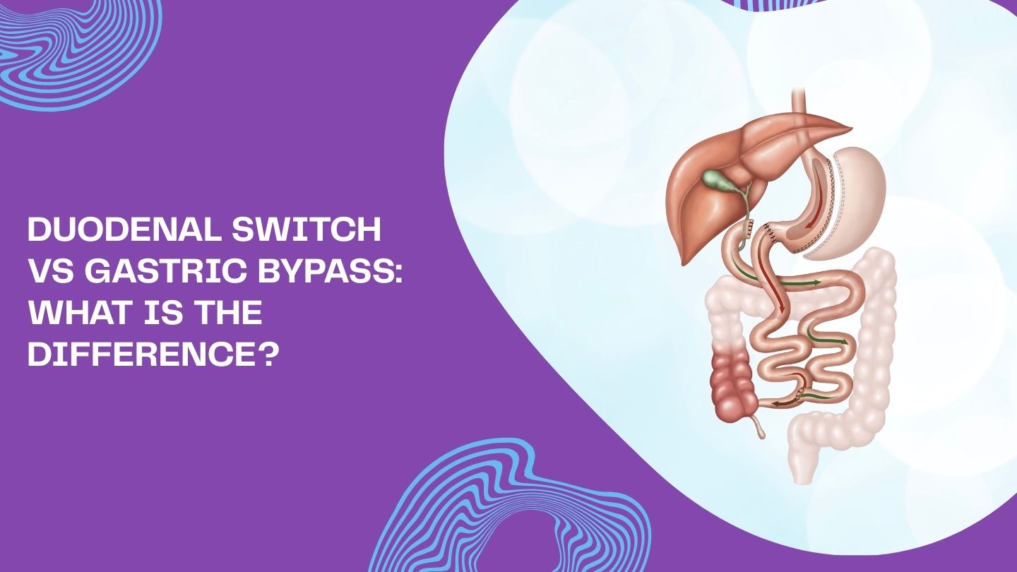 Duodenal Switch vs Gastric Bypass: What Is the Difference?