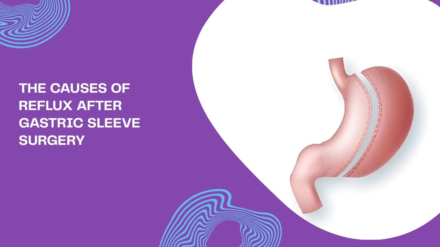 The Causes of Reflux After Gastric Sleeve Surgery